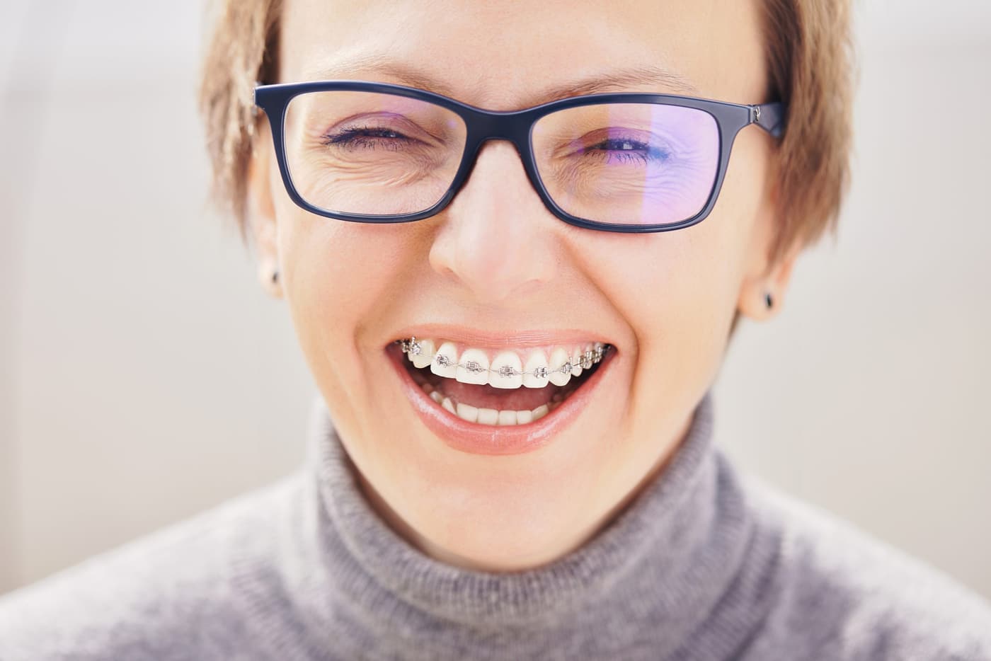 An adult patient smiling with braces