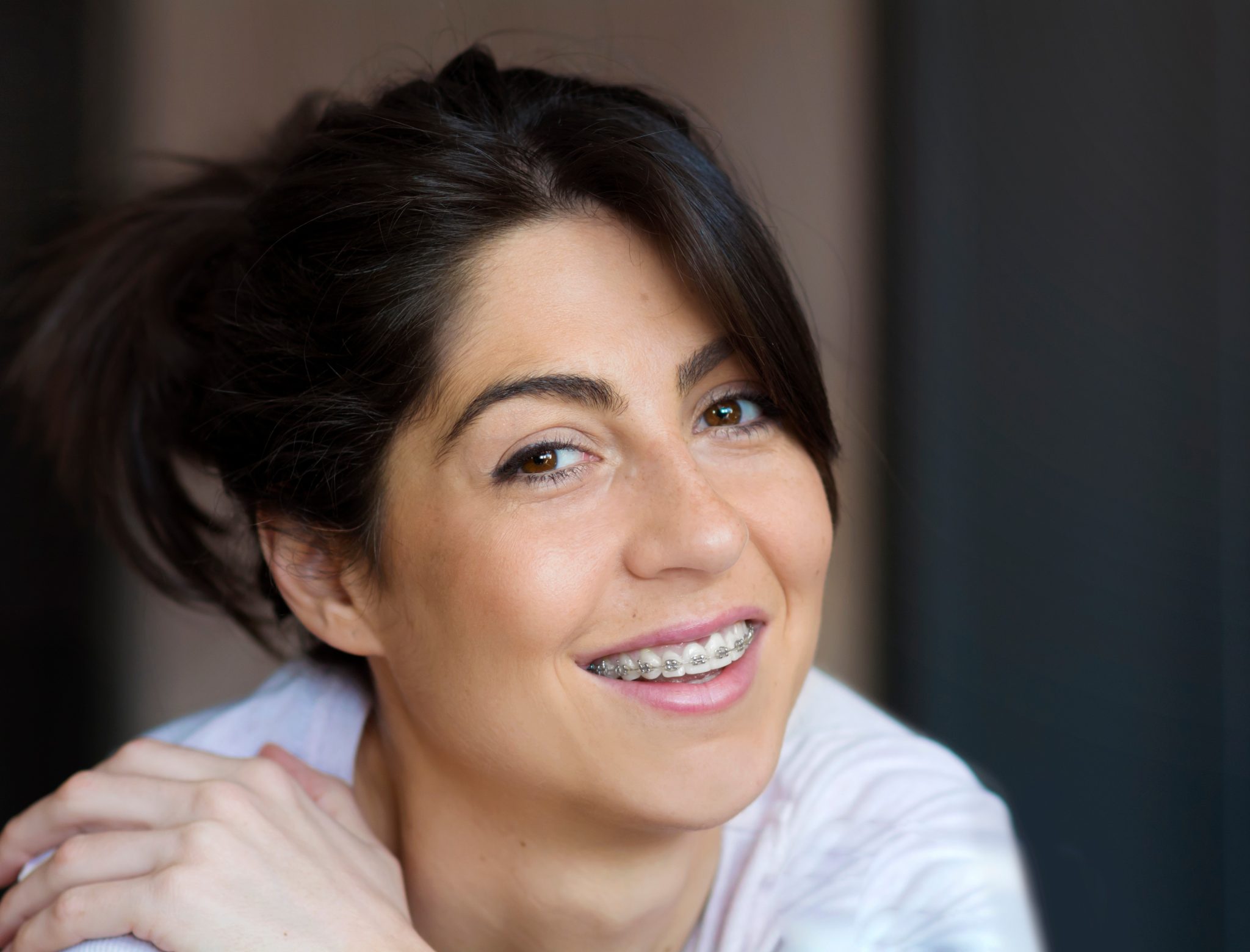 Braces for adults ___all_locations___