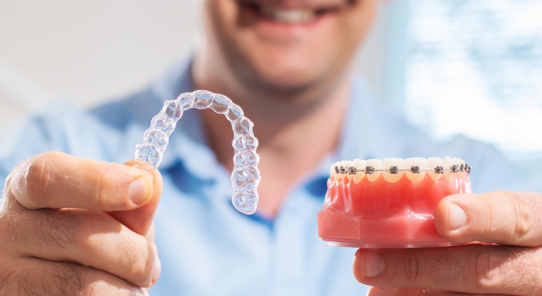 Braces vs Invisalign