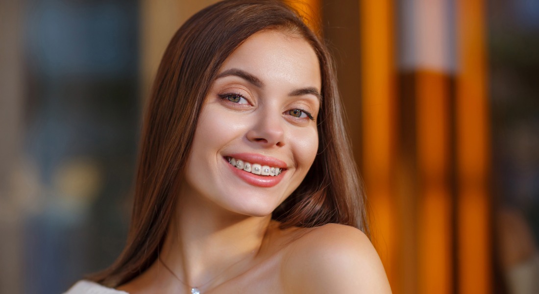 San carlos orthodontics